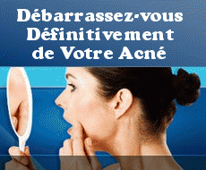 Traitement acné, comment vaincre l’acné de façon naturelle ?